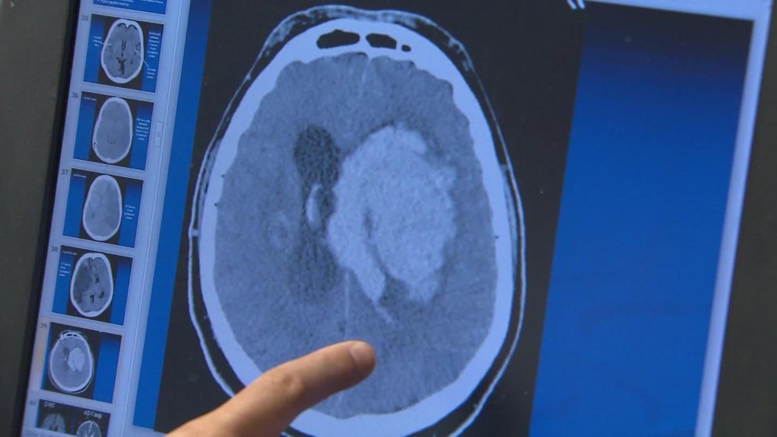 200120103648-alzheimer-demencia-hispanos-vive-la-salud-azaret-sueo-habitos-cnnee-00015014-full-169